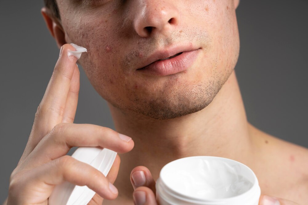 Young handsome man using a cream for acne